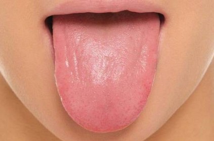 Pregnant wife bites off husband's tongue as he was not good looking