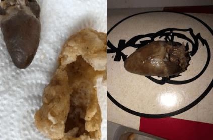 Man finds raw chicken heart inside KFC chicken